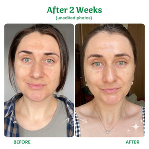Birch Babe Lighten, Tighten, Brighten (LTB)|3 Step Skincare 套裝 產品細節圖 2