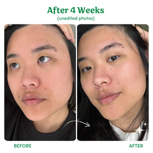 Birch Babe Lighten, Tighten, Brighten (LTB)|3 Step Skincare 套裝 產品細節圖 15